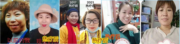 睡热疗美容效果005.jpg