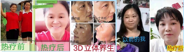 睡热疗美容效果011.jpg