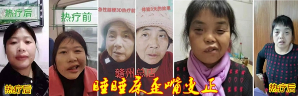 睡热疗美容效果009.jpg