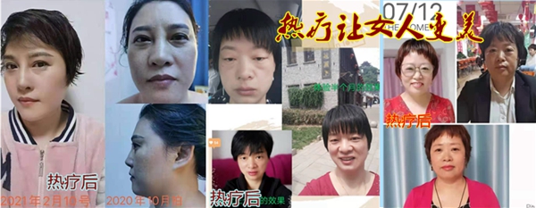 睡热疗美容效果004.jpg