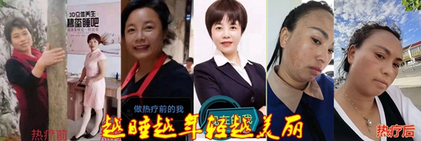 睡热疗美容效果001.jpg