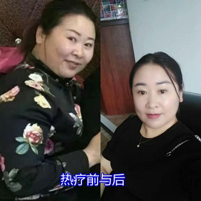 顾客反映：在睡吧热疗让自己变苗条了（六）